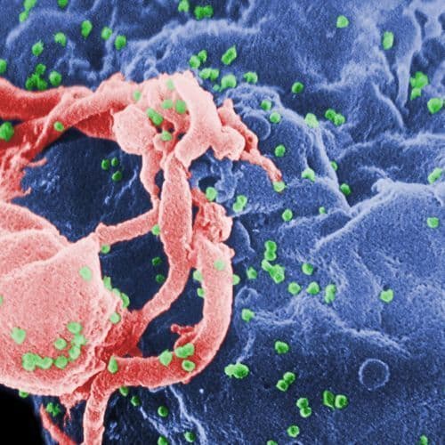 HIV and AIDS: Patient Cured by HIV Is Charité Employee