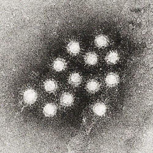 Emergency Vaccination: More than 4,000 Doses Due to Possible Alluvial and Overflow Diseases of the Mapocho